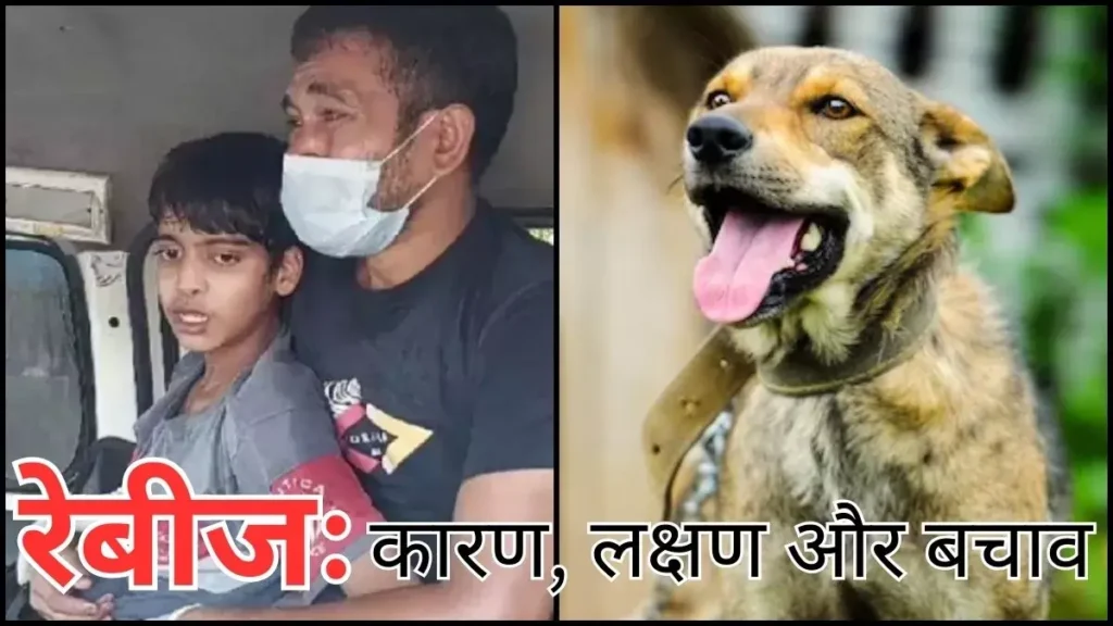 अहमदाबाद: इंस्पेक्टर वनराजसिंह मंजरिया का रेबीज से निधन, हो जाएं अलर्ट
