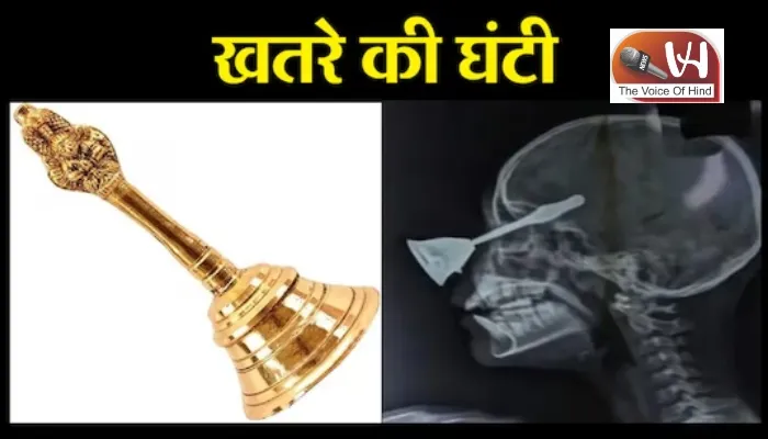 दीवाली पूजा में घंटी बनी जानलेवा, बच्ची के सिर में घुसी