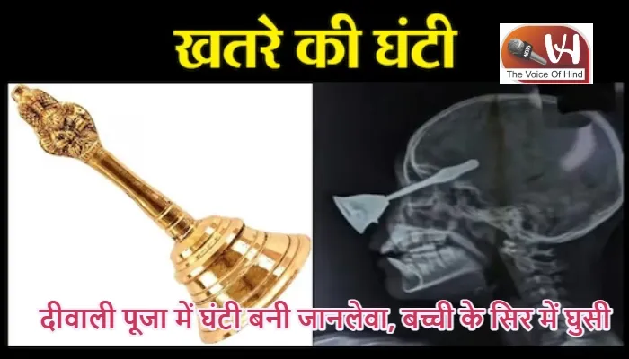दीवाली पूजा में घंटी बनी जानलेवा, बच्ची के सिर में घुसी